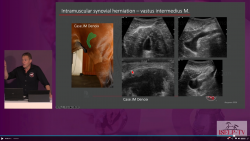 thumbnail for The Pelvis & Hip 2026